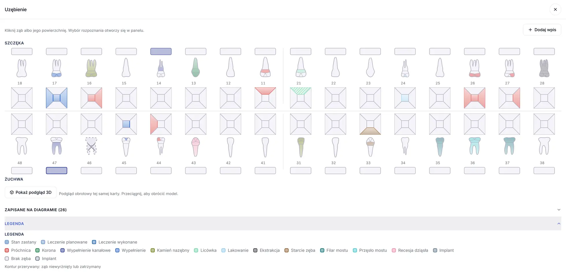 Diagram zębów w numeracji FDI w programie ZenMed, zęby od 18 do 48 z powierzchniami i legendą rozpoznań