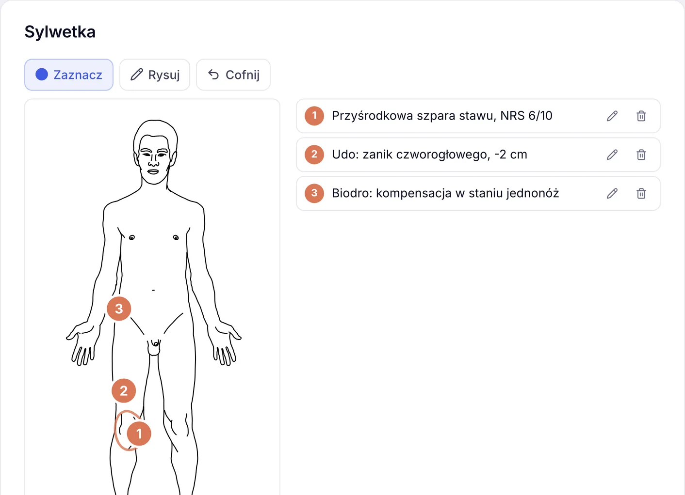 Sylwetka pacjenta w karcie wizyty ZenMed z trzema numerowanymi znacznikami i odręcznym obrysem obrzęku przy prawym kolanie